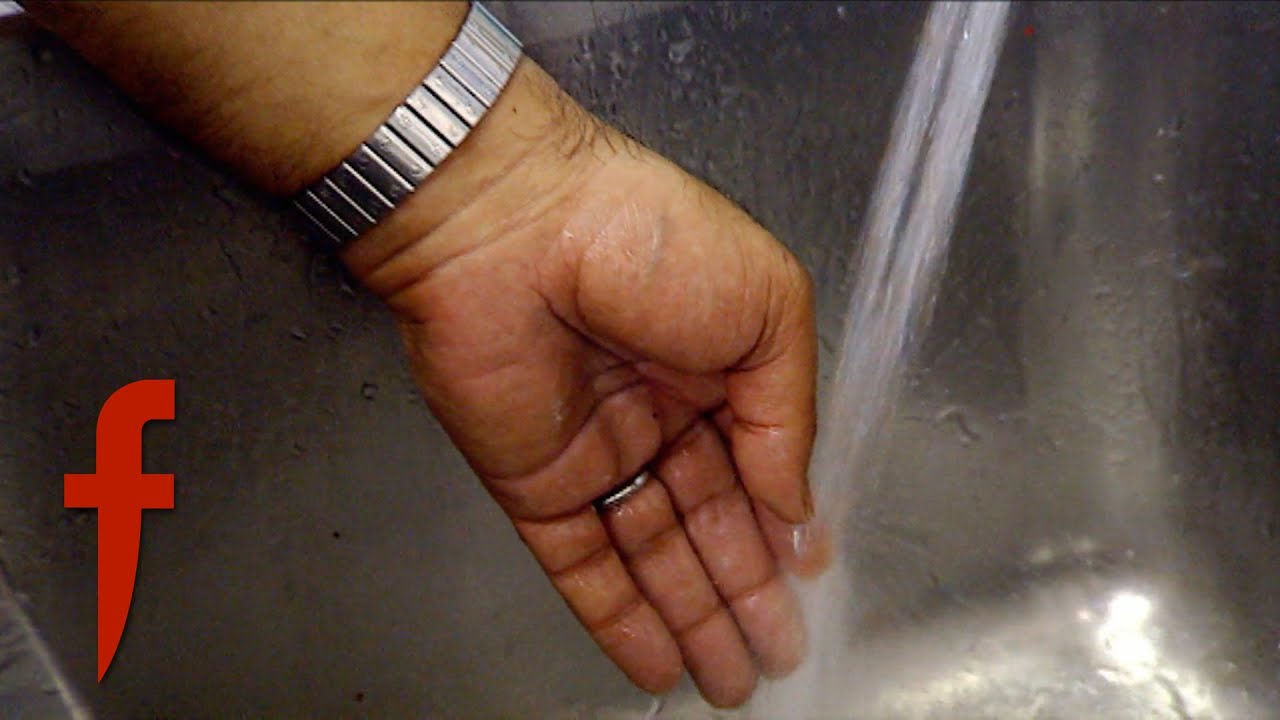 War Journalist Burns His Finger | The F Word With Foxy Games